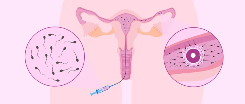 Procedimiento de fertilidad